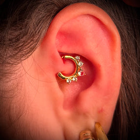 Surgical Gold Ring