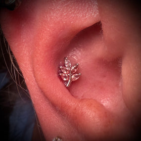 Surgical Threadless Leaf