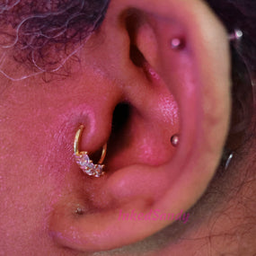 Surgical Gold Ring