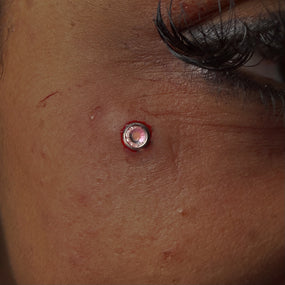 Titanium Basic Dermal